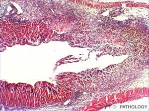 Stomach from fingerling tilapia showing acute gastritis, especially on the right of the image. Here we can also see loss of gastric glands. H&E. 