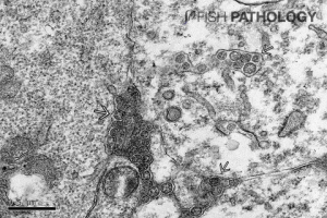 Transmission electron micrograph from liver of fingerling tilapia with SHT. Virus particles, typical of orthomyxovirus, can be seen between and within cells (arrows).