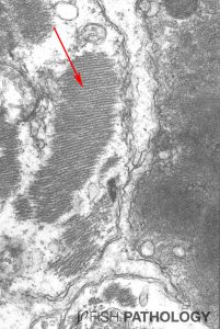 Figure 6. Transmission electron micrograph of heart from salmon with early-stage CMS to show the junction between 3 myocardial cells. The cells on the left and at the bottom show still-viable myofibrils (arrow), while in the cell on the right, the myofibrils have lost all structure.