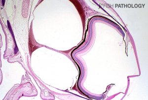 Figure 2B. The histopathology of Figure 2A shows large gas bubbles within the choroidal rete that have caused marked enlargement of the entire globe plus distortion of the retina, and inevitable blindness.