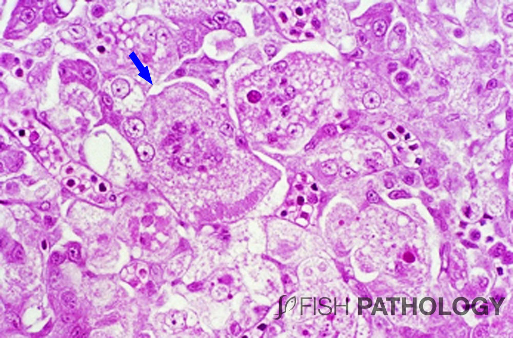 Figure 6. Hígado de trucha arcoíris con “syndrome cardio-hepático” donde se observa varios hepatocitos multinucleados de gran tamaño con una marcado citoplasma vacuolado. Esta extraña enfermedad esta asociada a un virus intranuclear tipo herpes. 