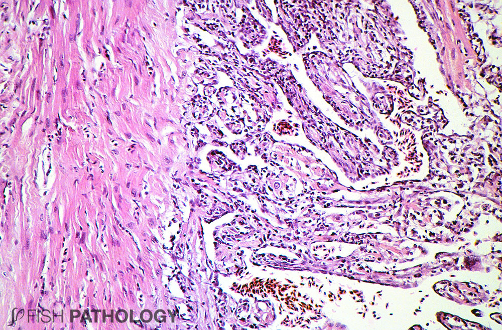 Figura 2. CMS en ventrículo de Salmón atlántico. Nótese la severa miocarditis en la capa esponjosa. La capa compacta (a la izquierda), en gran medida no se ve afectada.